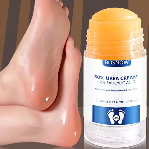 60% Urea + 2% Salicylic Acid Hand and Foot Cream