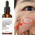 30ml Lactose Acid Serum