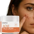 CHGEMIUE Salicylic Acid 50 Grams
